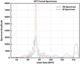 動態(tài)離散周期變換技術(shù)突破：無ECG參考的生理信號精準解析