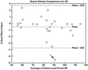 動態(tài)離散周期變換技術(shù)突破：無ECG參考的生理信號精準解析
