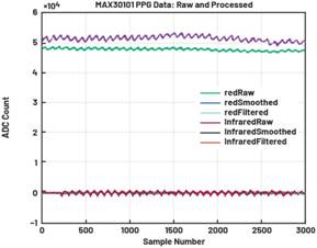 動態(tài)離散周期變換技術(shù)突破：無ECG參考的生理信號精準解析